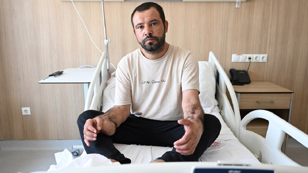 Doku nakli hayat kurtardı! Elektrik akımına kapılan işçi ölümden döndü...