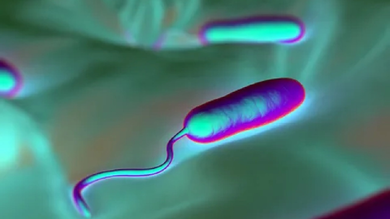 Avrupa'da görülmüştü! Vibrio bakterisi Türkiye'de de ortaya çıktı...
