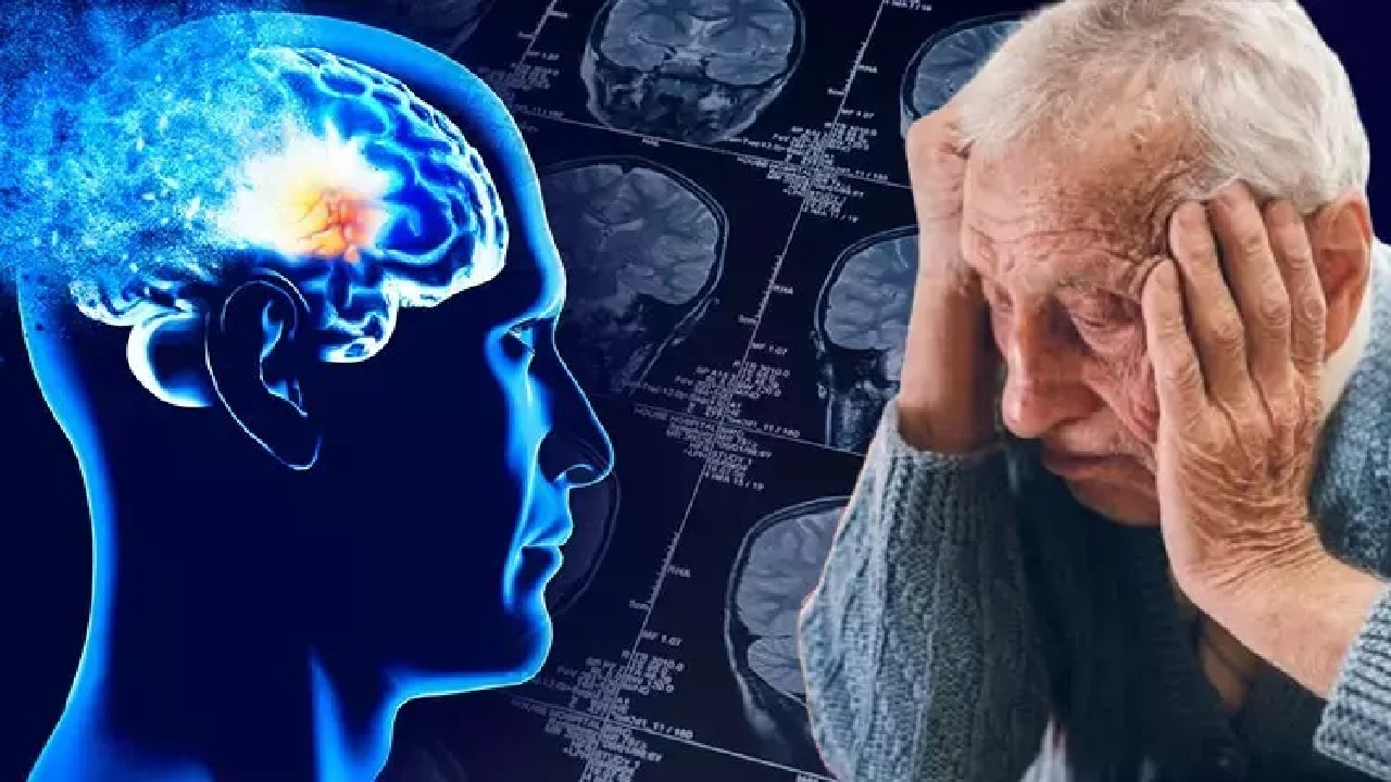 Alzheimer belirtilerine dikkat! Erken tanı hayat kalitesini yükseltiyor...