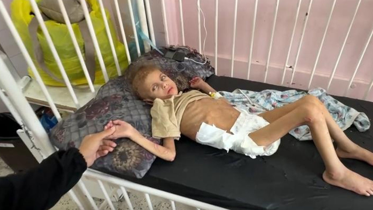 Gazze’de yetersiz beslenme sonucu 12 kiloya düşen 7 yaşındaki May yürüme yetisini kaybetti
