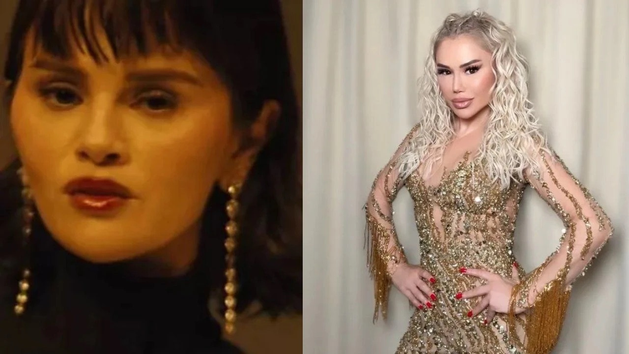 Dünyaca ünlü Selena Gomez estetiği abarttı! Şarkıcı Ceylan'a benzetildi...