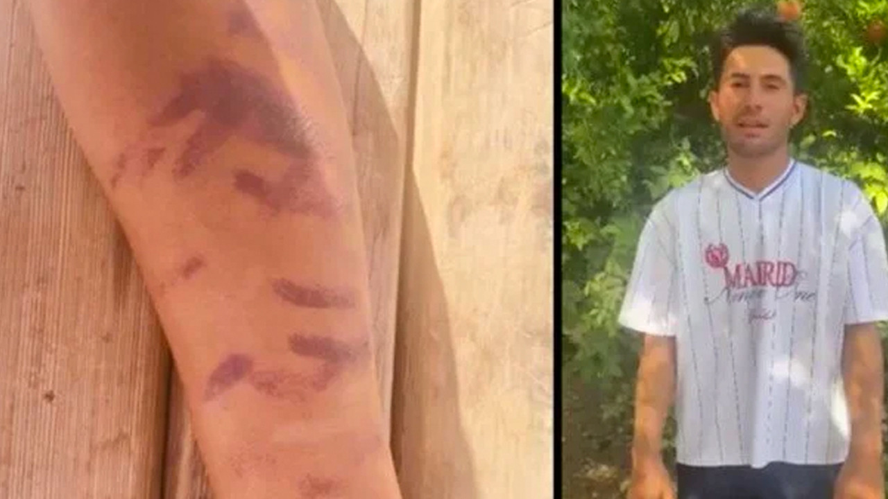 Yeni getirdikleri cihazı denemişler! Kürşat'ın başına gelen çok fena: “Ben yandım başkaları yanmasın"