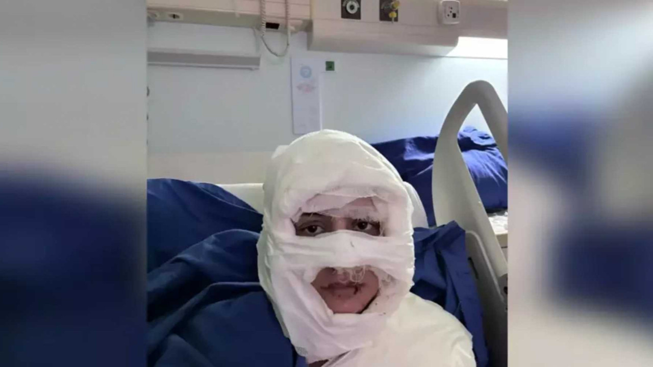 Korkunç olay! Genç kadını kolonya döküp ateşe verdi, tutuklandı