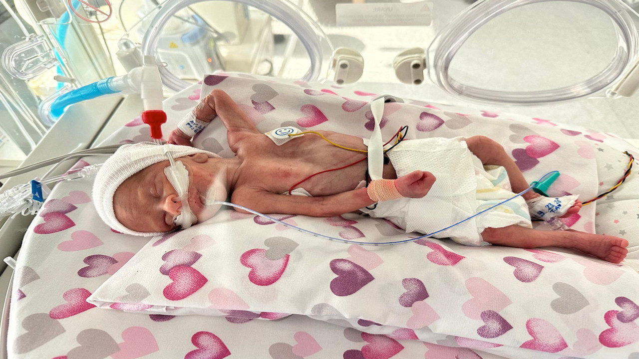 Dünya Prematüre Günü'nde minik Asil Ata'nın mucizevi yolculuğu! 600 gramlık mucize...