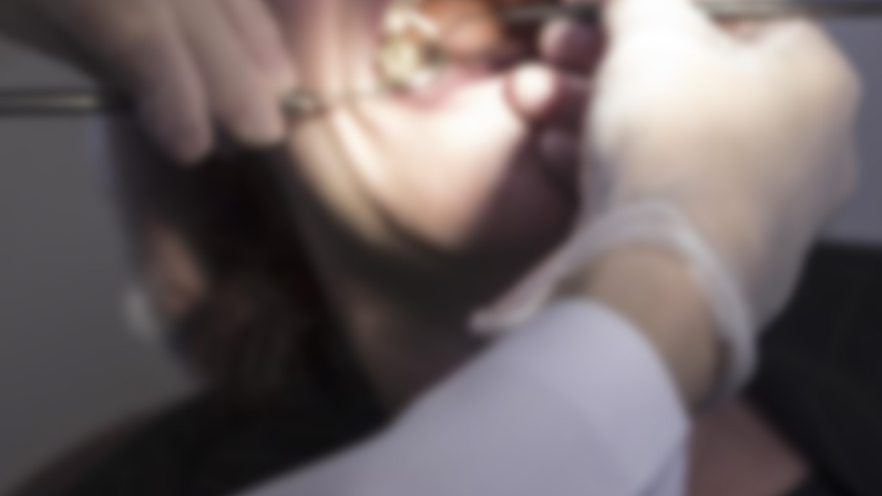 Bursa'da dişi çekilen çocuğun ölümüyle ilgili davada karar açıklandı