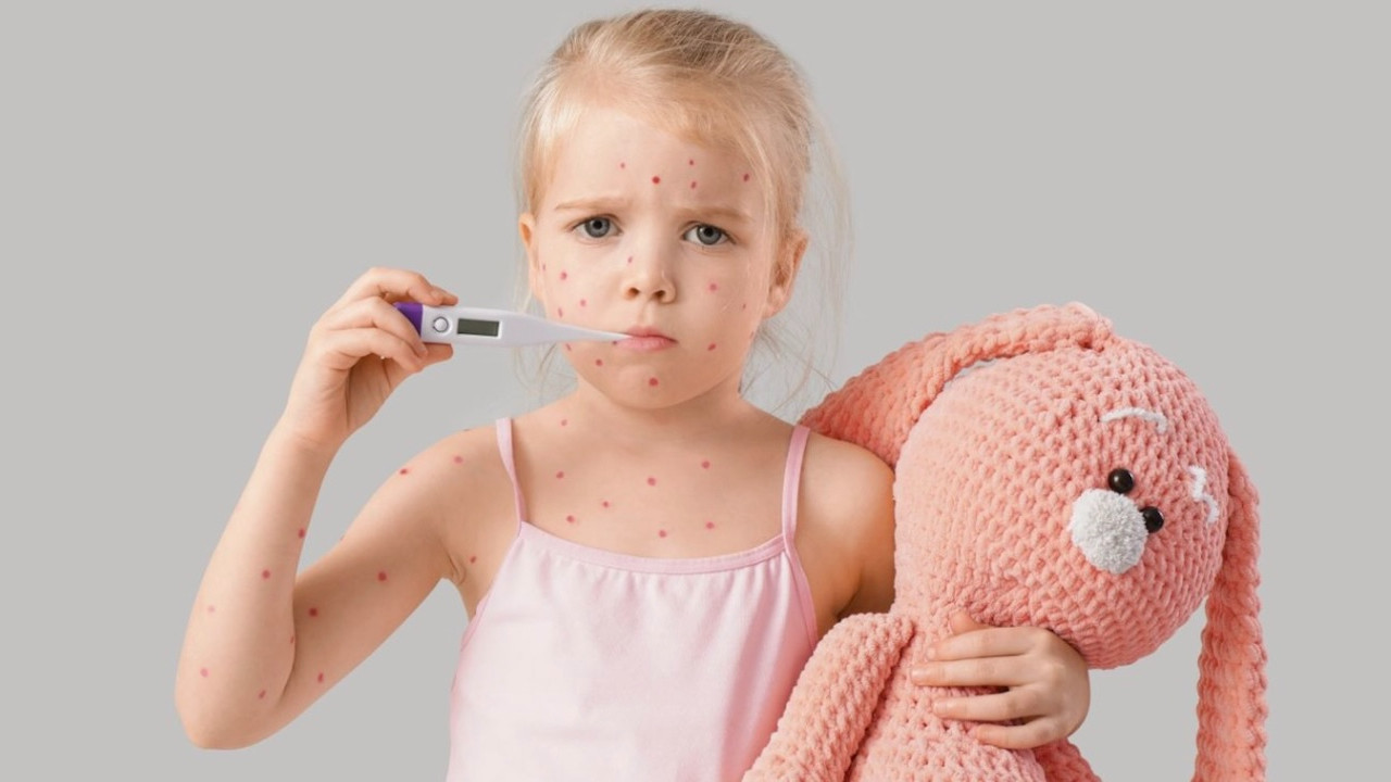 Okullarda yaşanan salgına dikkat! Su çiçeği vakaları giderek artıyor...