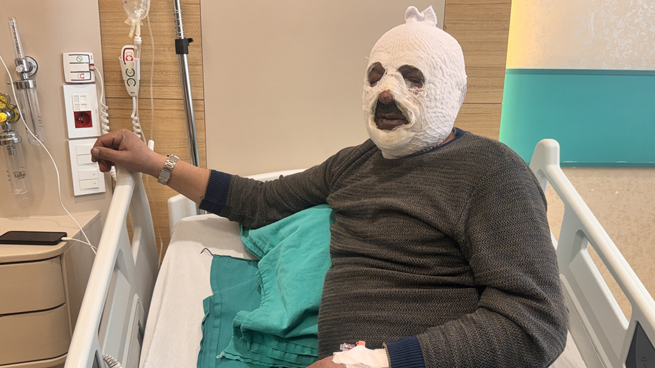 Arkadaşına yardım etmek istedi bu hale geldi! "Ben yandım kimse yanmasın"