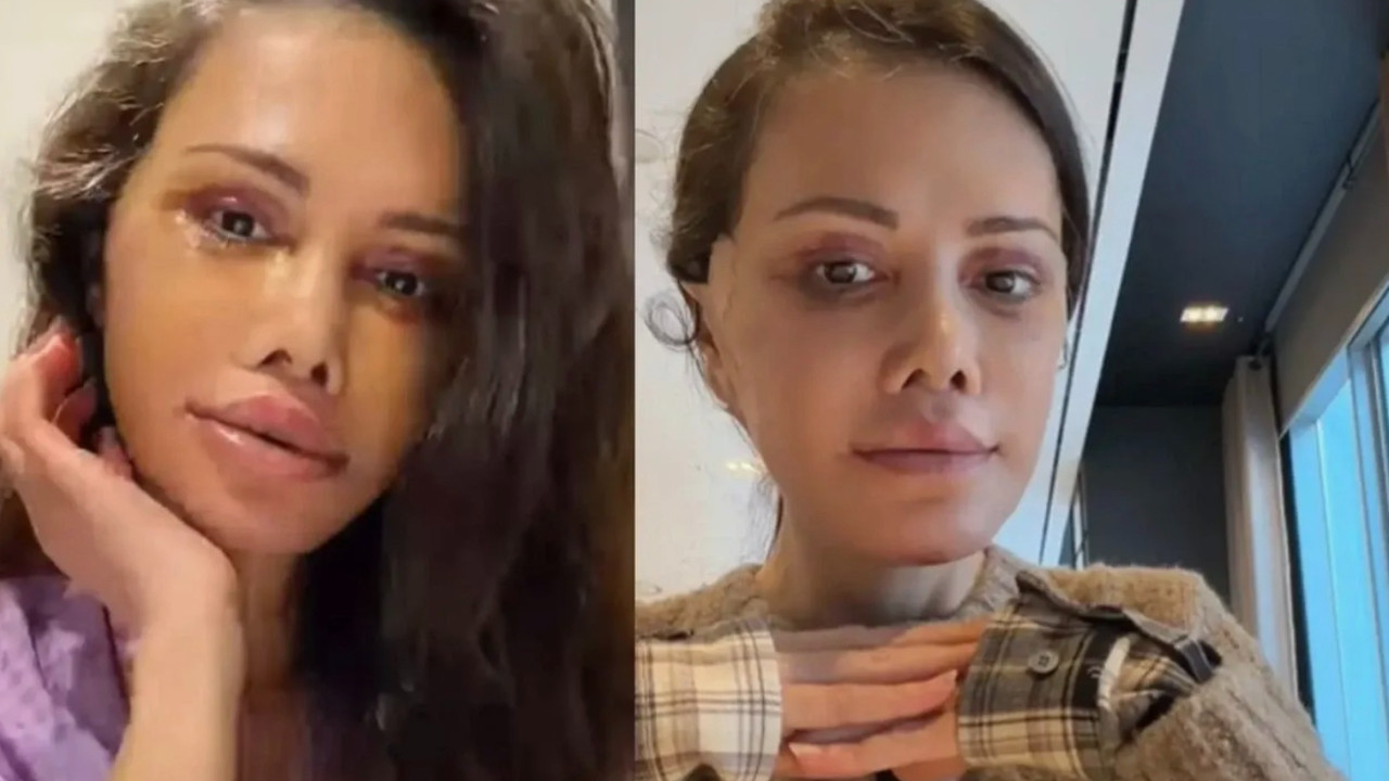 Didem Ceran'dan ameliyat sonrası ilk paylaşım! Yapılan işlemler...