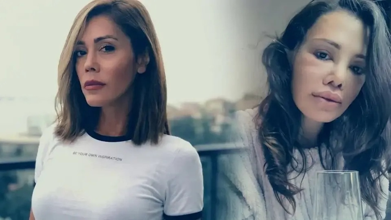 Didem Ceran yüz nakli sonrası yeniden paylaştı!