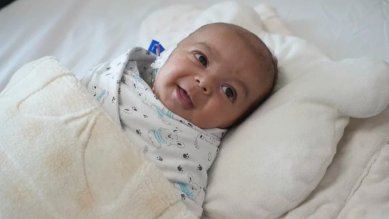 Tümörle doğan talihsiz bebek 4 saat sonunda sağlığına kavuştu...