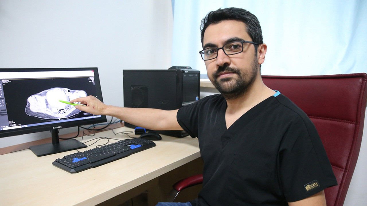 Doktorları bile şaşırttı! 43 yaşındaki kadının idrar kanalı ve mesanesinden 6 taş çıktı