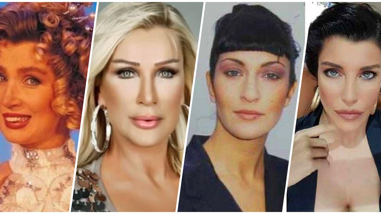 Estetik onlar için adeta mucize oldu! Estetikle adeta yeniden doğan ünlüler...