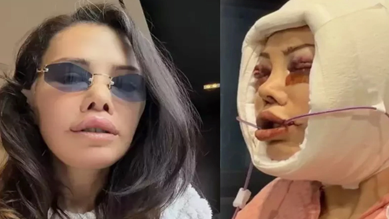 Yüz nakli yaptıran Didem Ceran son haliyle şoke etti: "Bebeksiyim, yapay zeka değil"
