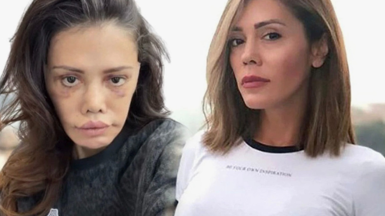 Didem Ceran'dan yeni kare! "Bu estetik değil, yeniden doğuş..."