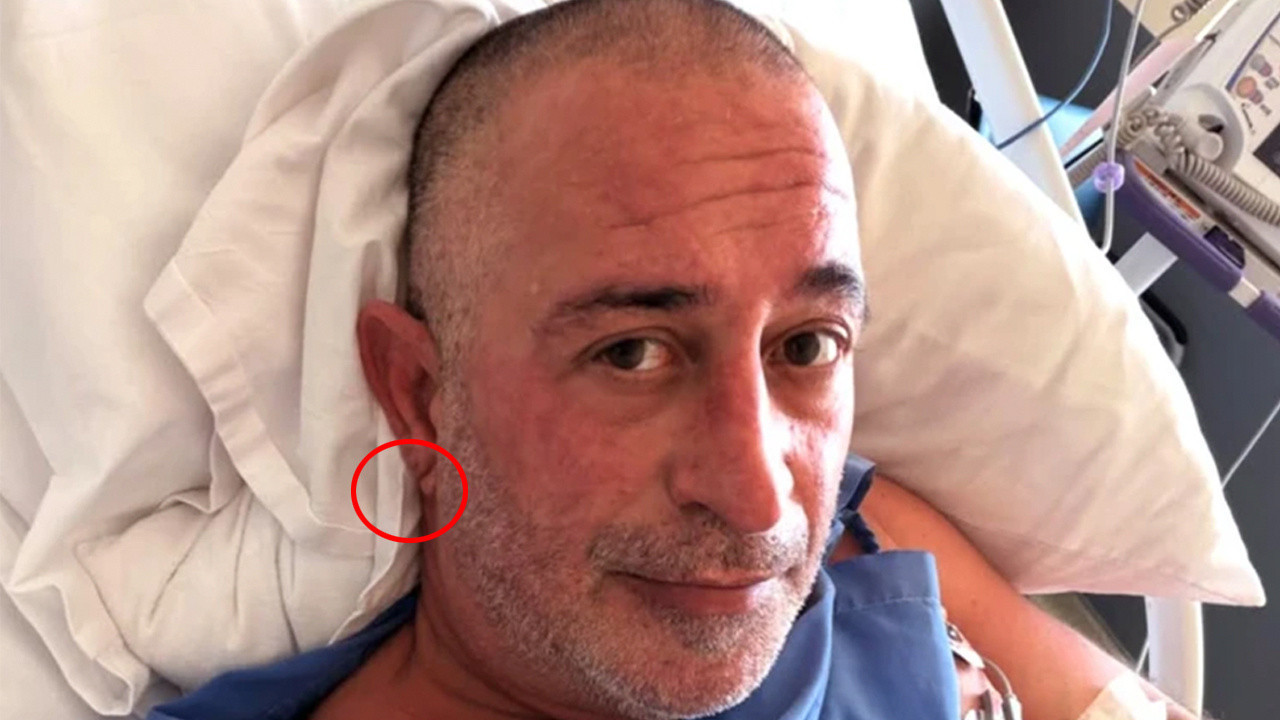 Cem Yılmaz kalp krizi geçirdi! Herkes kulak memesindeki o detayı konuşuyor