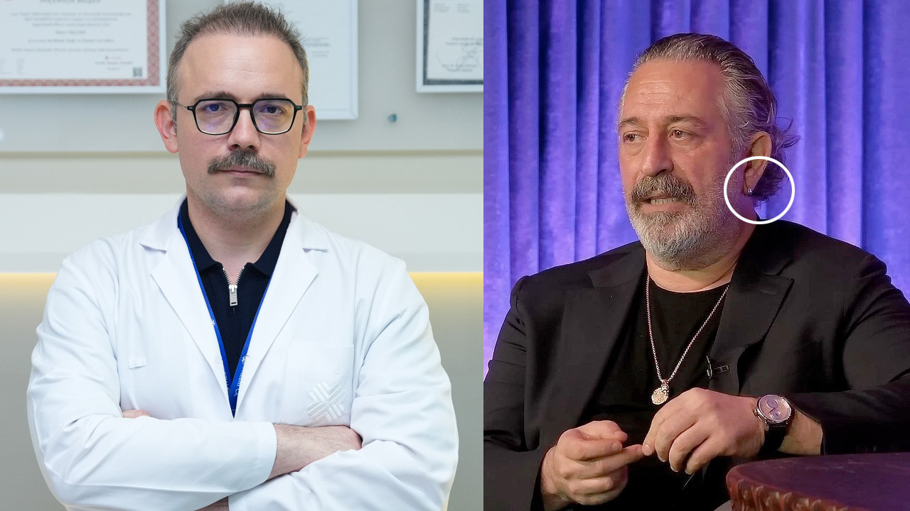 Kulak çizgisi gerçekten kalp krizi belirtisi mi? Cem Yılmaz'da görüldü doktor açıkladı