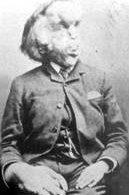 Bu kadının dört bacağı var - Resim: 2