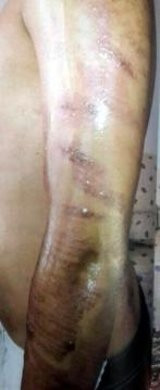 Tüylerinden kurtulmak istiyordu vücudu yandı - Resim: 4