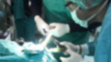 3 yaşındaki çocuğun midesinden ve boğazından çıkanlar şoke etti