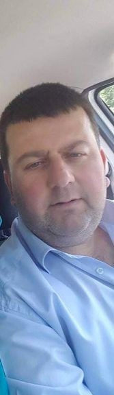 Sakarya'da dehşeti yaşadı! Can havliyle uykusundan uyandı yüzü tanınmaz hale geldi - Resim: 1