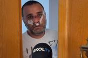 Çocuklarının gözü önünde darbedilen baba konuştu