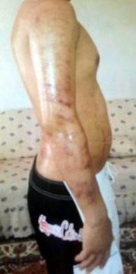 Tüylerinden kurtulmak istiyordu vücudu yandı - Resim: 1