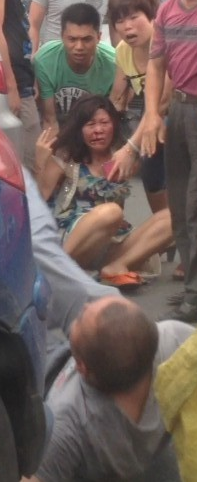 Yamyam kadının yüzünü yedi - Resim: 3