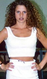 Bu ünlüler tam bir estetik bağımlısı  - Resim: 2