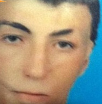 Türkiye'de 2. yüz nakli başladı! - Resim: 2