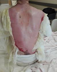 Eşini ve bebeğini yakıp 'yanlışlıkla oldu' demişti! Konya'daki vahşetin detayları - Resim: 0