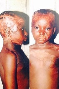 Doktorların yapamadığını kendisi yaptı! Şok olacaksınız - Resim: 2