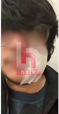 Yurt odasında görülmemiş işkence! Kemerle dövüldü, yüzüne ütü tutuldu, vücudunu kestiler! - Resim: 0