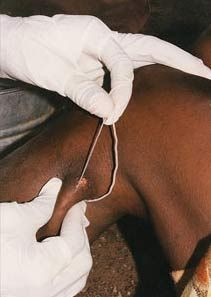 Dünyanın en korkunç parazitleri! - Resim: 3