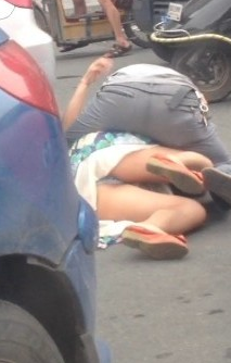 Yamyam kadının yüzünü yedi - Resim: 2