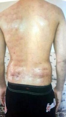 Tüylerinden kurtulmak istiyordu vücudu yandı - Resim: 3