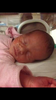 İkizler el ele doğmuştu.. Bakın şimdi nasıl büyüdüler - Resim: 3