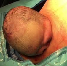 Bu anı gören doktorlar oradan kaçtı bebek bekleyemedi - Resim: 3