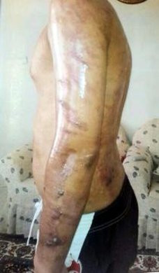 Tüylerinden kurtulmak istiyordu vücudu yandı - Resim: 2