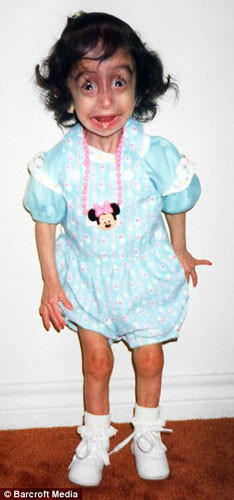 Genç kız zayıflığıyla görenleri hayrete düşürdü - Resim: 3