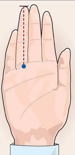 Prostat kanseri riskiniz var mı? - Resim: 3