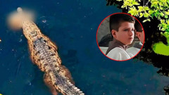 Brezilya'da korkunç olay! Bir çocuk köpekbalığı saldırısı sonucu öldü...