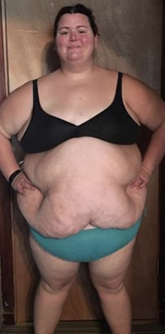 Yok böyle değişim! 87 kilo verdi bambaşka biri oldu - Resim: 3