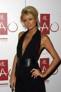 Ünlülerde rezil olur! - Resim: 2