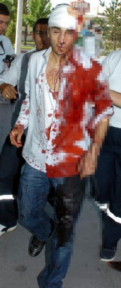 Yan bakma tartışmasına kan bulaştı - Resim: 3