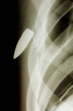 Dünyanın en ilginç röntgenleri! - Resim: 2