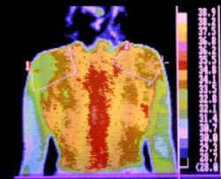 Bu bilgisayar doktorlardan daha başarı çıktı - Resim: 2