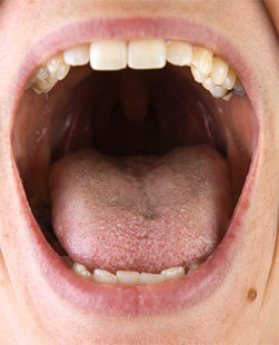 Ağız kokusunu önlemenin yolu! - Resim: 2