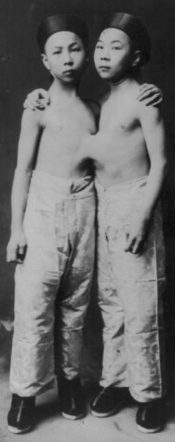 Bu ikizleri birbirinden ayırmak mümkün değil - Resim: 3