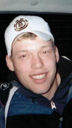 Yüzü parçalanmıştı şimdiki haline bakın - Resim: 1