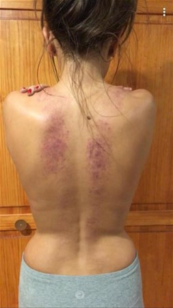 Kimse dediklerine inanmadı daha sonra vücudu bu hale geldi - Resim: 4